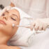 BENEFITS OF Microdermabrasion